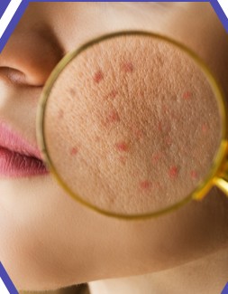 Dermatologist Doctor Sylhet - Specialist Doctor in Sylhet