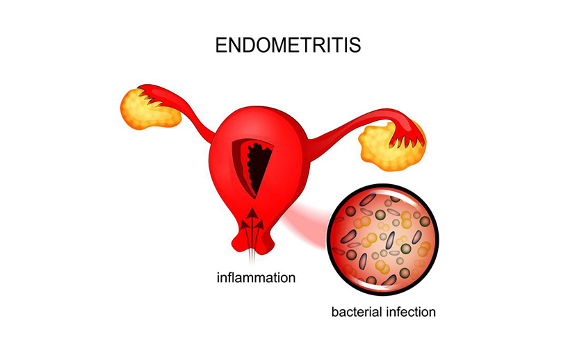 সিজার পরবর্তী জটিলতা | মা ও শিশু কী কী সমস্যায় পড়ে?