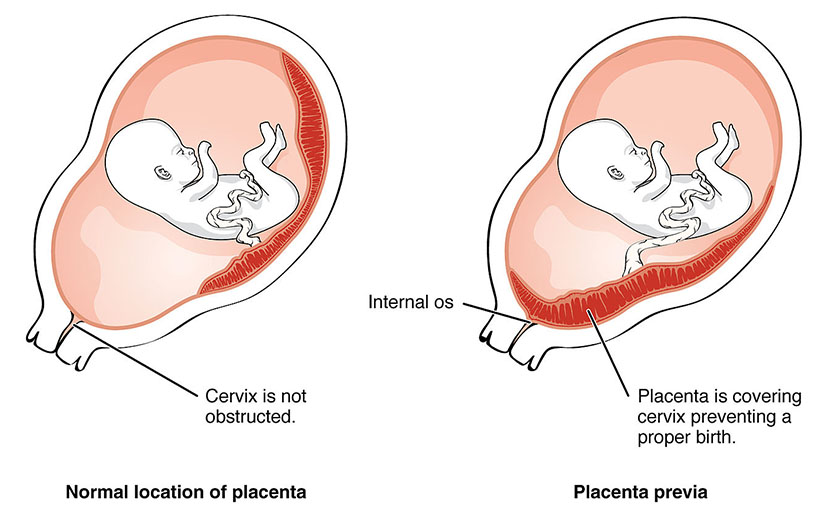 গর্ভাবস্থায় মায়ের ৮টি বিপদ চিহ্ন নিয়ে জানা আছে তো?