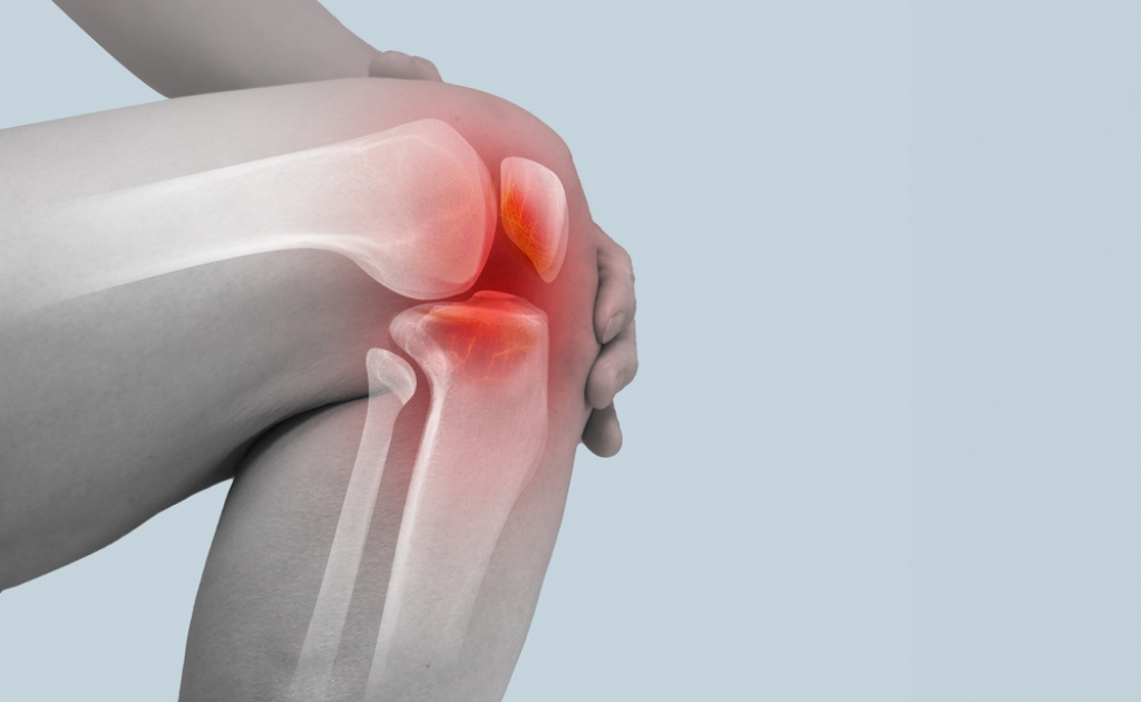 হাঁটু ব্যথা থেকে পরিত্রাণের কিছু কার্যকর উপায়