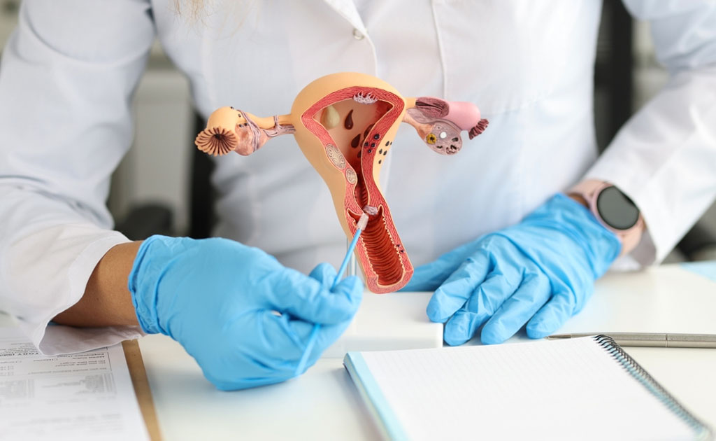 ইউটেরাস বা জরায়ু অপসারণ কখন ও কী কী কারণে করা হয়?