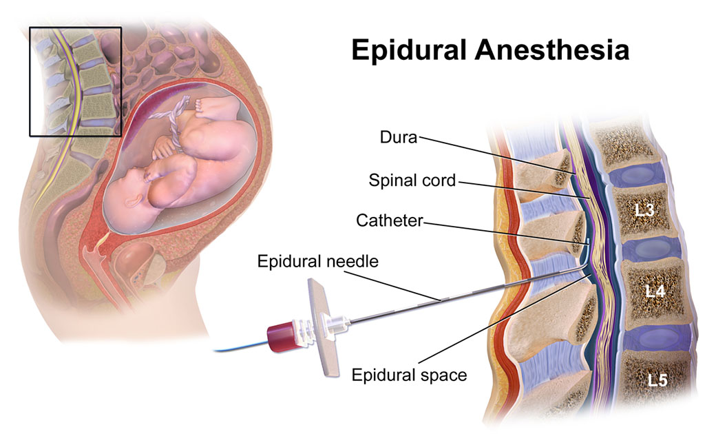 ব্যথামুক্ত নরমাল ডেলিভারি | এই প্রক্রিয়ার সুবিধাগুলো কী কী?